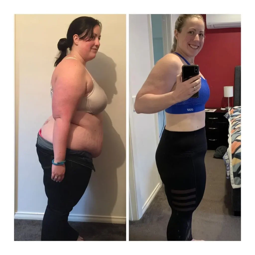 mulher-viciada-em-fast-food-encara-dieta-e-perde-63kg-24082020161413185